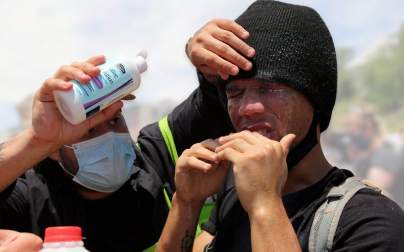 Anti-ICE Protesters Caught on Video Saying “Shoot ICE!” After Dallas Shooting, Get Pepper Balls Shot at Them  – EVOL