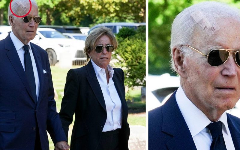 Biden spotted with giant bandage on head after having surgery to treat skin cancer  – EVOL